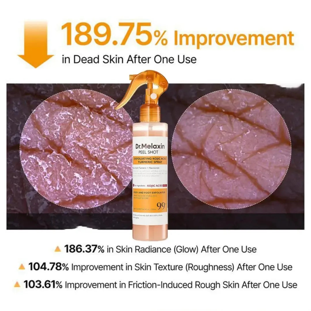 Body Keratin Care Acid Turmeric Spray with Gentle Body Brightening & Exfoliating Peeling Solution Korean Skincare, 6.76 Fl.Oz