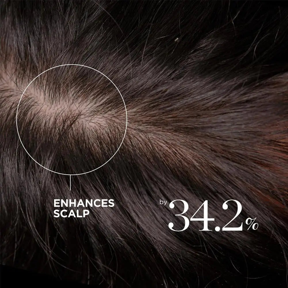 Dr.Groot Anti-Hair Loss Care Set Shampoo Conditioner Removing Dandruff Oil Control Deep Moisturizing Smooth Frizzy Hair